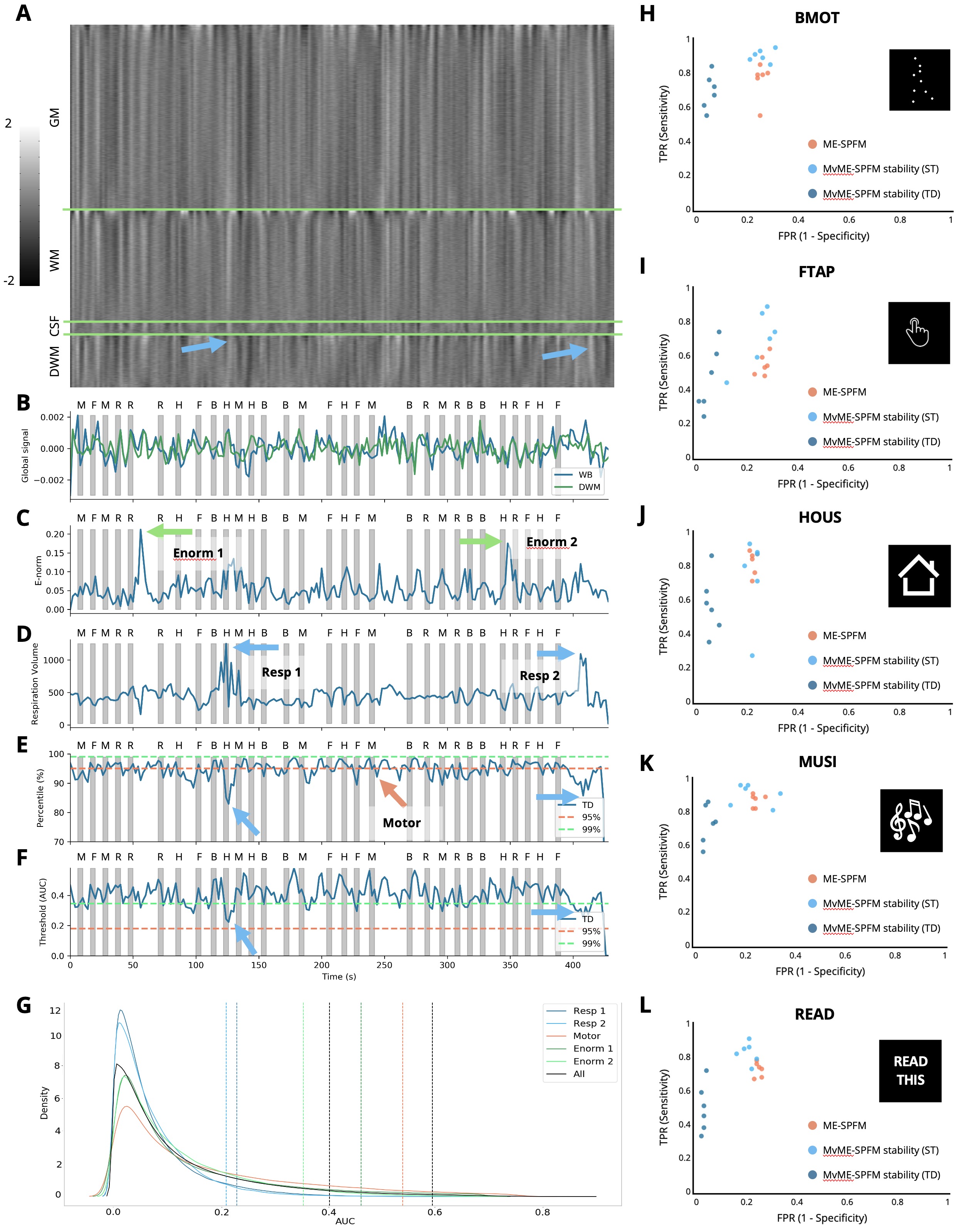 Representative subject with motion and respiration artifacts. A: Grayplot of the second echo
volume. The grayplot is divided into 4 sections: gray matter (GM), white matter (WM), cerebrospinal fluid (CSF), and
deep white matter (DWM). B: Time-series of the global signal calculated in the whole brain (WB, blue) and
the deep white matter (DWM, green). C: Euclidean norm (e-norm) of the temporal derivative of the realignment parameters. D: respiration volume signal. E: AUC percentile corresponding to the time-dependent threshold (lines at 95th
and 99th percentiles are shown for reference). F: AUC values corresponding to the time-dependent threshold
are shown in blue. The horizontal dashed lines indicate the 95th (orange) and 99th (green) percentiles corresponding to
ST thresholding. Gray bars in B-F indicate the onset and duration of each trial in the paradigm, with their
respective initials on top. Blue arrows point out two respiration-related events, green arrows point out two
motion-related events, and the orange arrow points out a finger-tapping event. G: Probability density
functions (estimated by kernel density estimate) of the AUC values corresponding to the instances of the two
respiratory-related events (blue lines), a representative time-point of one finger-tapping trial (orange line), the
two largest peaks in the e-norm trace (green lines), and the overall AUC distribution (black). The corresponding
coloured vertical dashed lines indicate the AUC value for the 95th percentile of the TD thresholding approach, along
with the 95th and 99th AUC values of ST thresholding. H-L: Receiver operating characteristic (ROC) values
for the original ME-SPFM (orange), and proposed MvME-SPFM technique with the use of stability selection with the ST
(light blue) and TD (dark blue) thresholding approaches for this dataset. The ROC plots depict the sensitivity and
specificity of the methods at correctly estimating the activity maps that correspond to the 6 trials of each task in
the paradigm.