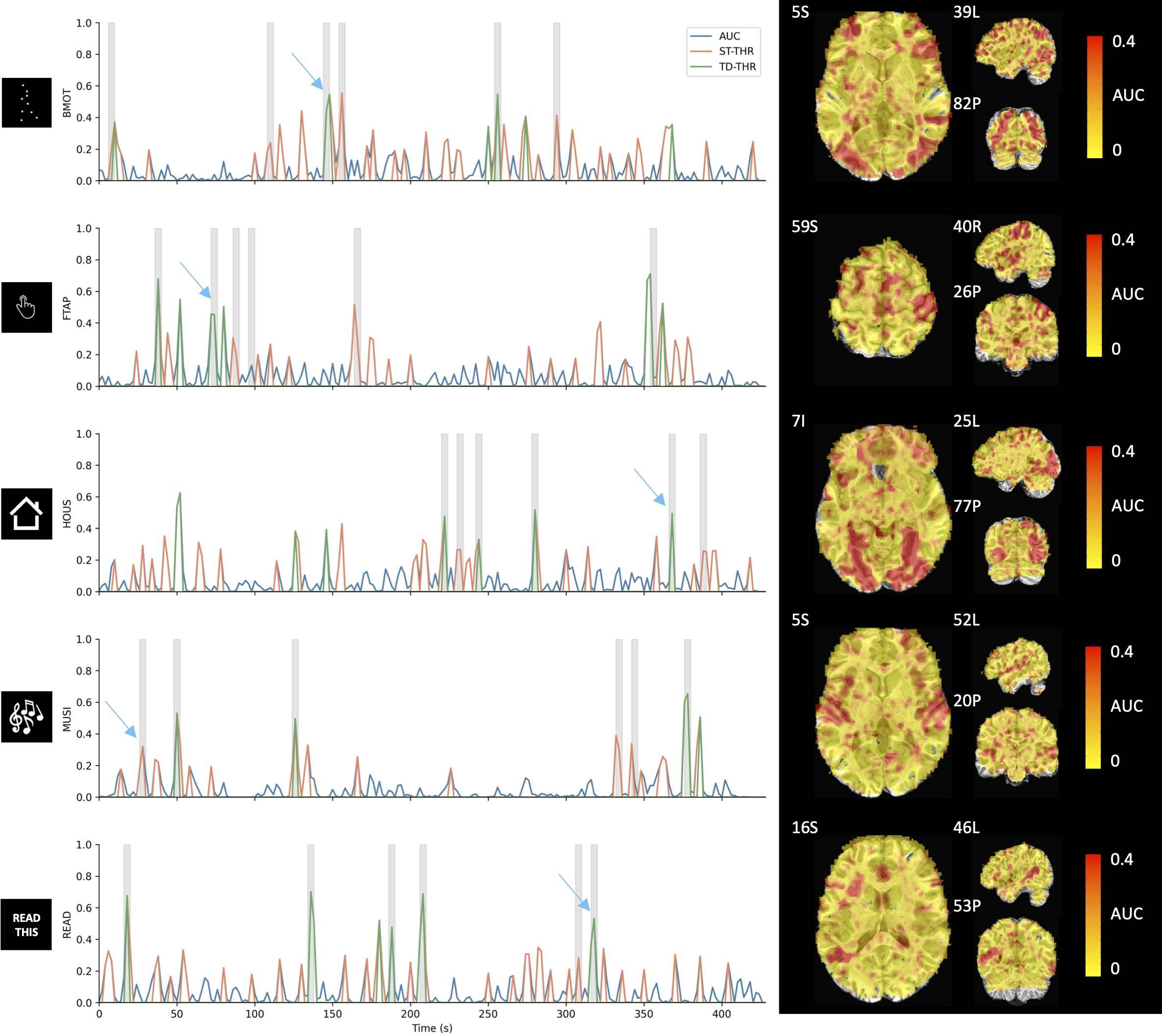 Left: Original (blue), ST thresholded (orange) and TD thresholded (green) AUC time-series for a
representative voxel for each task in the paradigm (\rho=0.5). Note that the three time-series are overlaid; i.e.,
the static and time-dependent time-courses are thresholded versions of the original AUC. Gray blocks depict the
onset and duration of each trial. Right: AUC maps at the time-points signaled by the blue arrows.