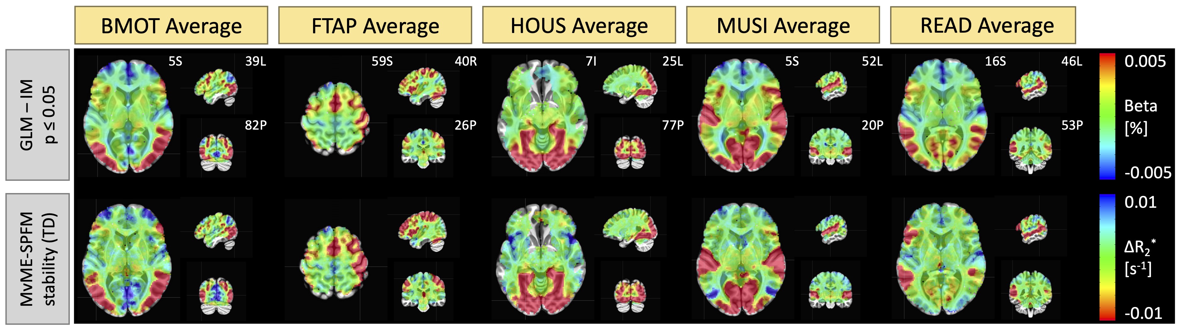 Average activity maps across trials, sessions and subjects for each condition in the task obtained with (top) a single-trial
GLM analysis (independently modulated, IM) and the proposed MvME-SPFM algorithm with stability selection, \rho=0.5
and a time-dependent threshold (TD).