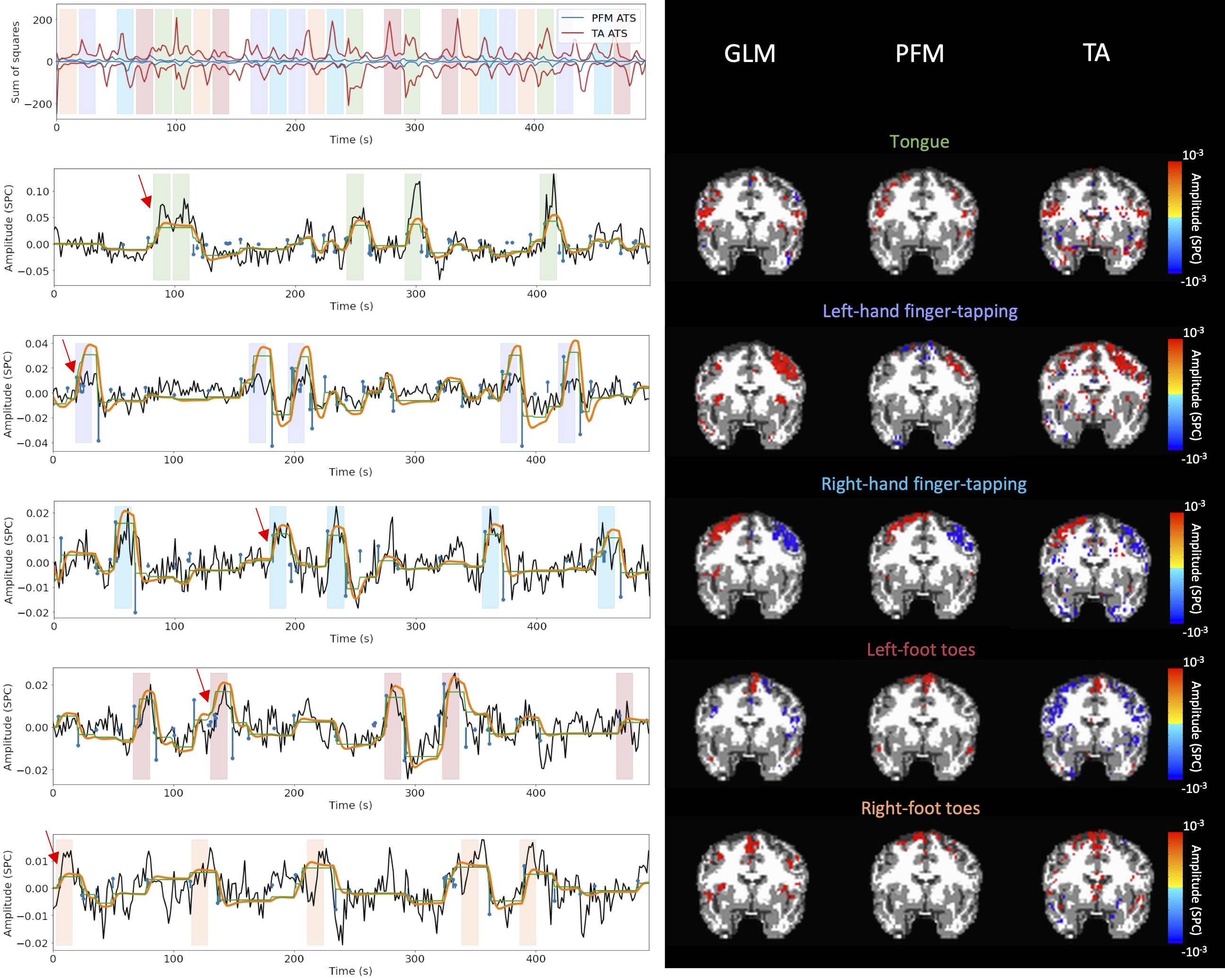 Activity maps of the motor task using a seletion of \lambda based
on the MAD estimate. Row 1: Activation time-series of the innovation signals
estimated by PFM (in blue) or TA (in red) calculated as the sum of squares
of all voxels at every timepoint. Positive-valued and negative-valued
contributions were separated into two distinct time-courses. Color-bands
indicate the onset and duration of each condition in the task (green:
tongue, purple: left-hand finger-tapping, blue: right-hand finger-tapping,
red: left-foot toes, orange: right-foot toes). Rows 2-6: time-series of a
representative voxel for each task with the PFM-estimated innovation (blue),
PFM-estimated activity-inducing (green), and activity-related (i.e., fitted,
orange) signals, with their corresponding GLM, PFM, and TA maps on the
right. The maps shown on the right are sampled at the time-point labeled
with the red arrows and display the innovation signals at that moment across
the whole brain.